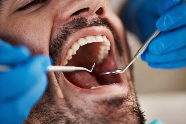 Best Emergency Dental Extractions in Gravette, AR