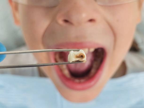 Best Urgent Dental Care for Toothache in Gravette, AR